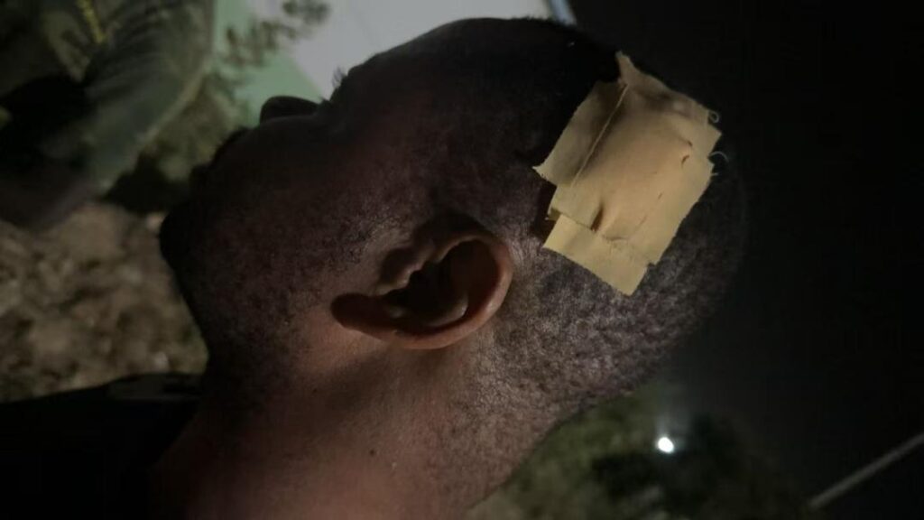 SECURITY GUARD INJURED IN UNDERGROUND ATTACK BY ILLEGAL MINERS