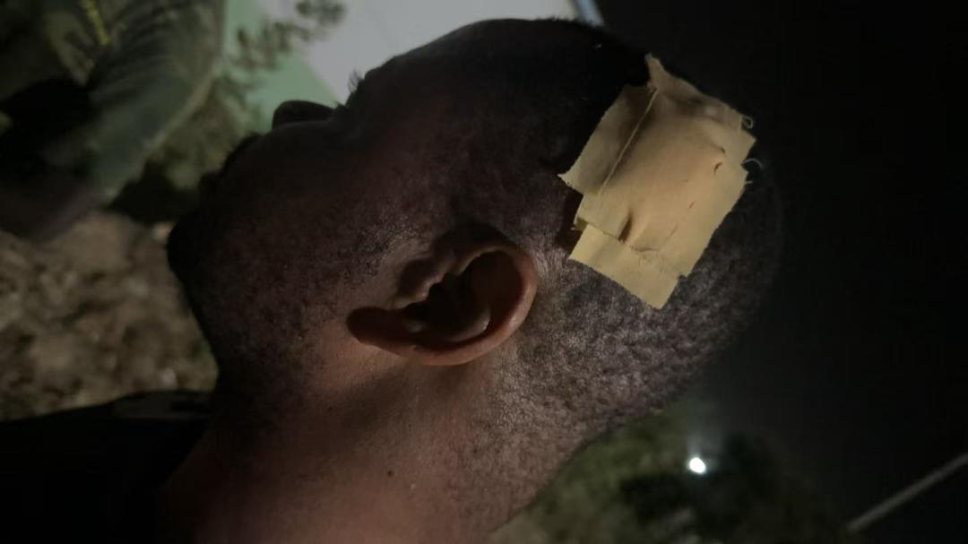 Security Guard Injured in Assault by Illegal Miners at Earl International Group Ghana Gold Ltd.